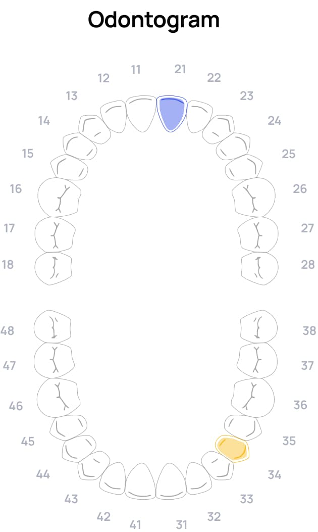 Teeth Set